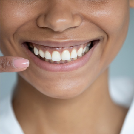 ARESTIN Gum Treatment