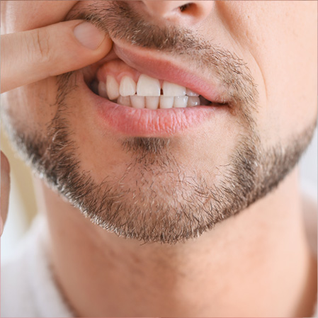 Gum Disease Treatment